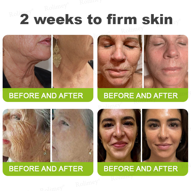 C🇺🇸Made and shipped from the USA ⌛Rolimey® Botox & Vita-A Retinol Shot Wrinkle-Lift Tightening cream - Last Day Promotion 70% OFF