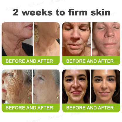 C🇺🇸Made and shipped from the USA ⌛Rolimey® Botox & Vita-A Retinol Shot Wrinkle-Lift Tightening cream - Last Day Promotion 70% OFF