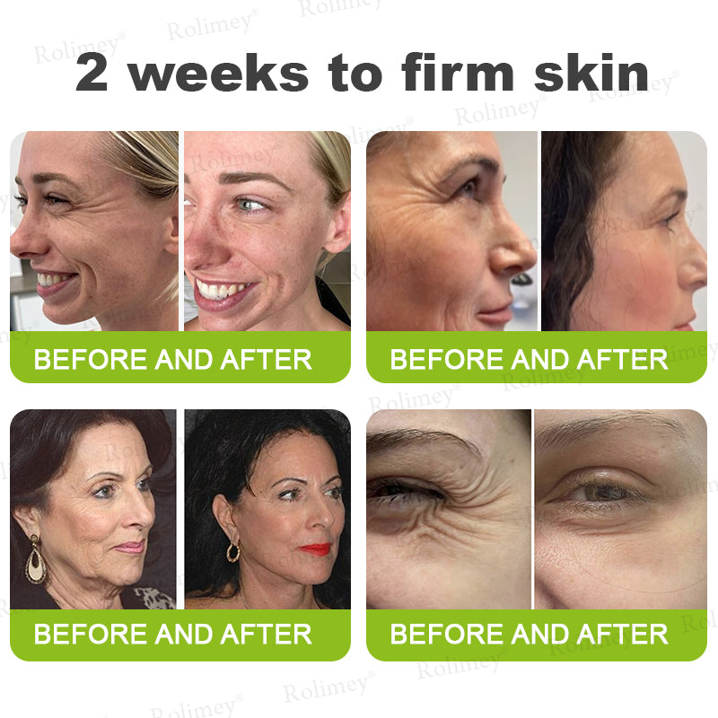 C🇺🇸Made and shipped from the USA ⌛Rolimey® Botox & Vita-A Retinol Shot Wrinkle-Lift Tightening cream - Last Day Promotion 70% OFF