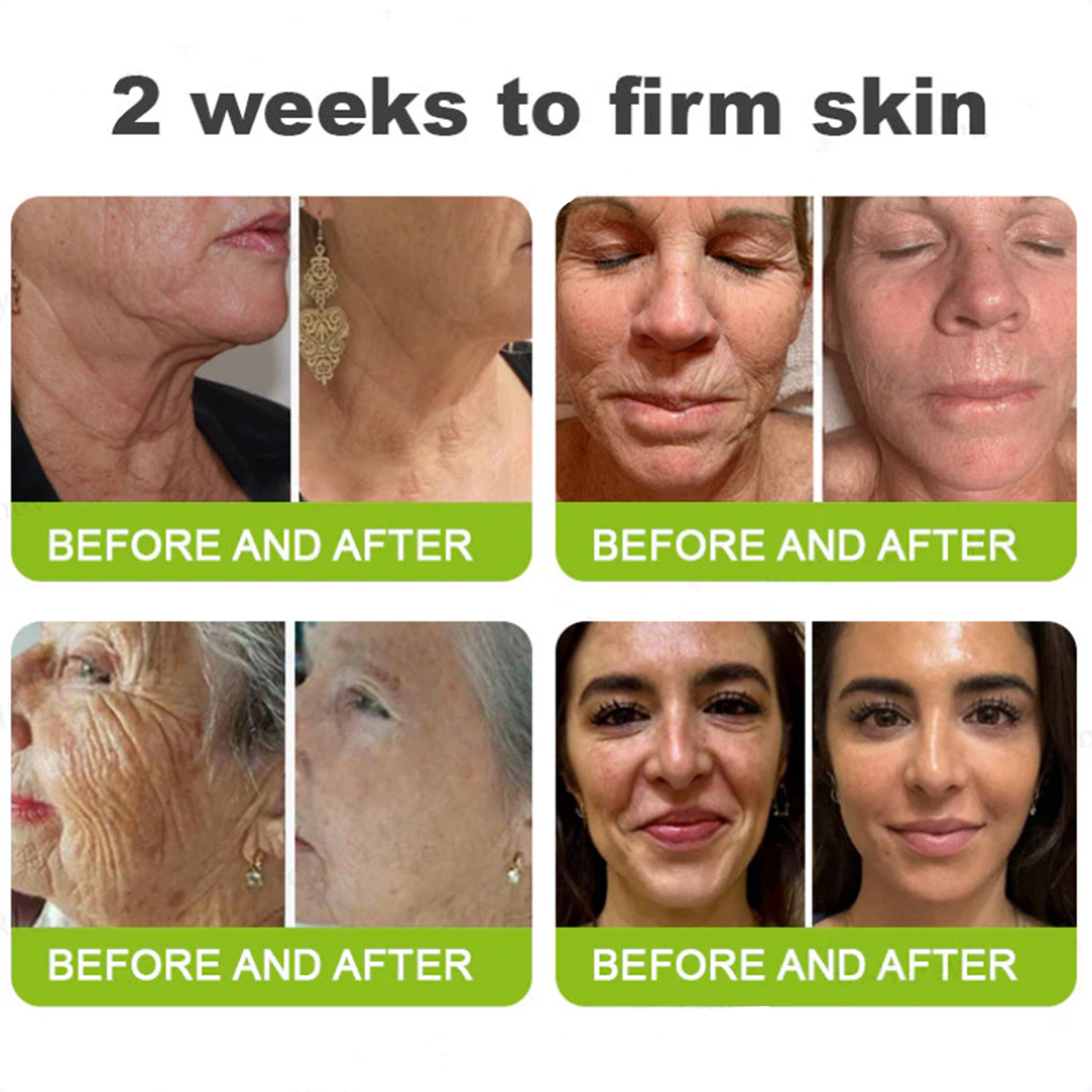 Dr. Fachmer®👩‍⚕️ Peptide Collagen INSTANT TIGHTENING + PEPTIDE FIRMING CARE, Instantly smooths puffiness and lines while supporting firmer skin with continued use