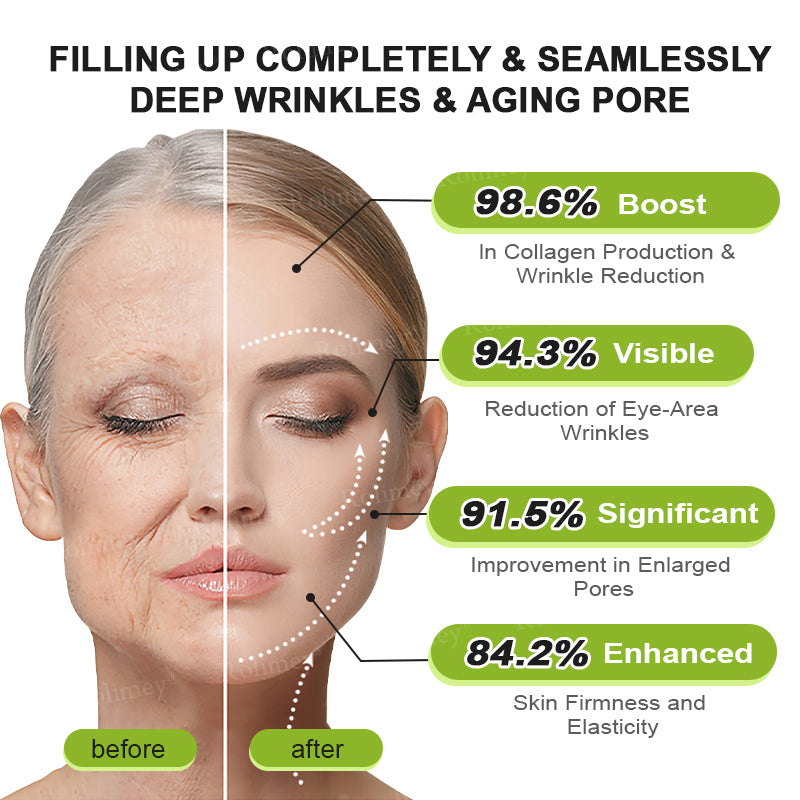 C🇺🇸Made and shipped from the USA ⌛Rolimey® Botox & Vita-A Retinol Shot Wrinkle-Lift Tightening cream - Last Day Promotion 70% OFF
