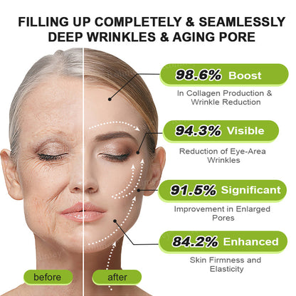 C🇺🇸Made and shipped from the USA ⌛Rolimey® Botox & Vita-A Retinol Shot Wrinkle-Lift Tightening cream - Last Day Promotion 70% OFF