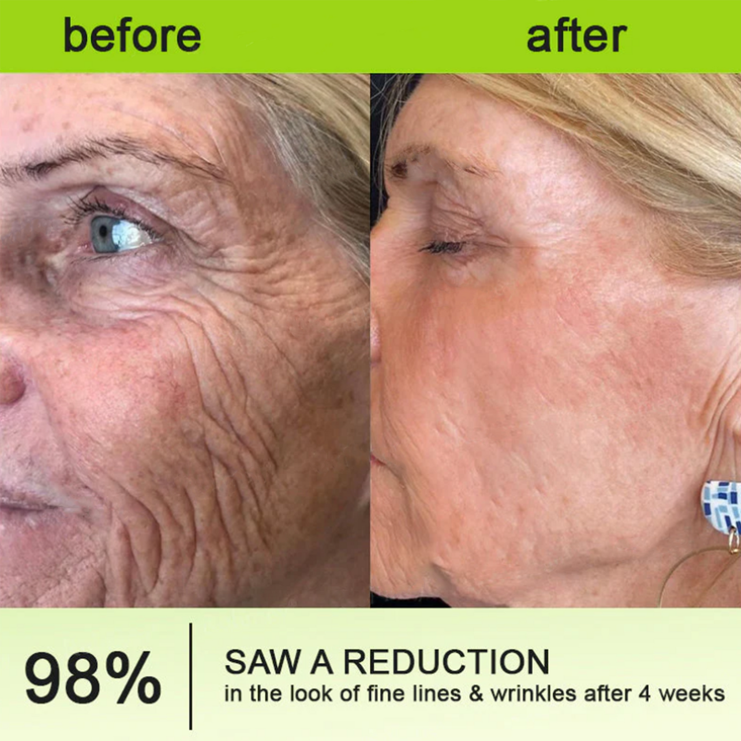 Dr. Fachmer®👩‍⚕️ Peptide Collagen INSTANT TIGHTENING + PEPTIDE FIRMING CARE, Instantly smooths puffiness and lines while supporting firmer skin with continued use