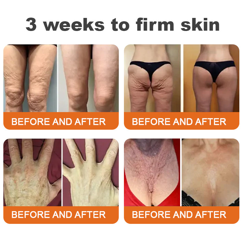 💫Rolimey® BEE VENOM Skin Restoration Cream (⏳LAST DAY 70% OFF)✨