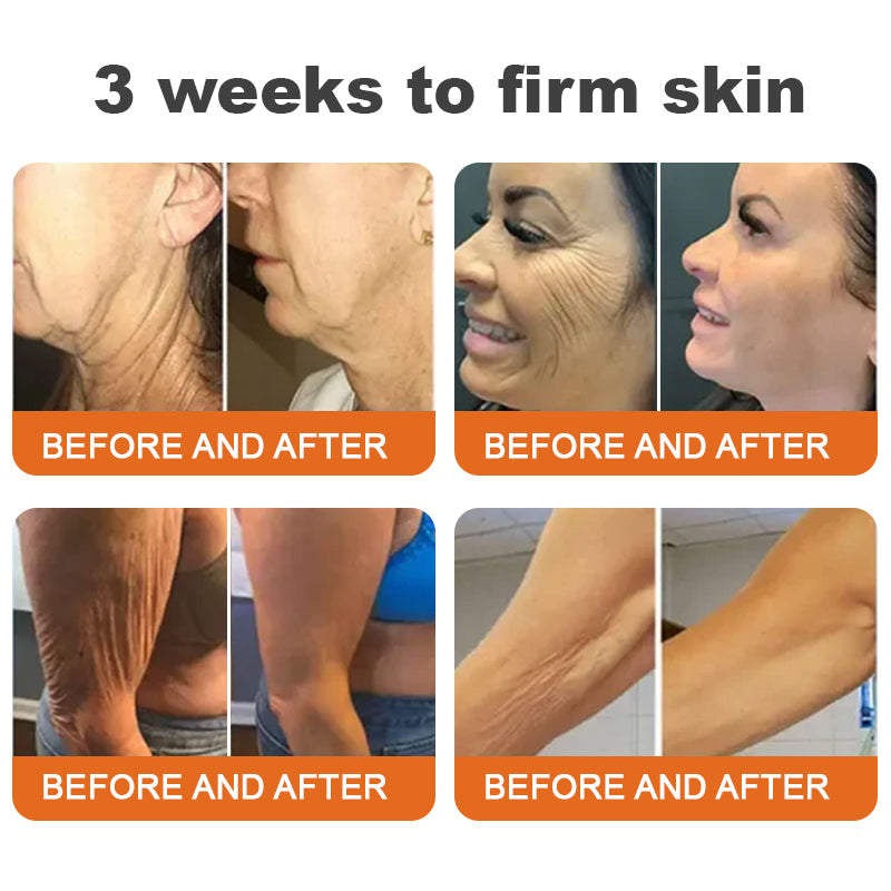 💫Rolimey® BEE VENOM Skin Restoration Cream (⏳LAST DAY 70% OFF)✨