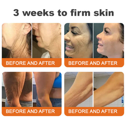 💫Rolimey® BEE VENOM Skin Restoration Cream (⏳LAST DAY 70% OFF)✨