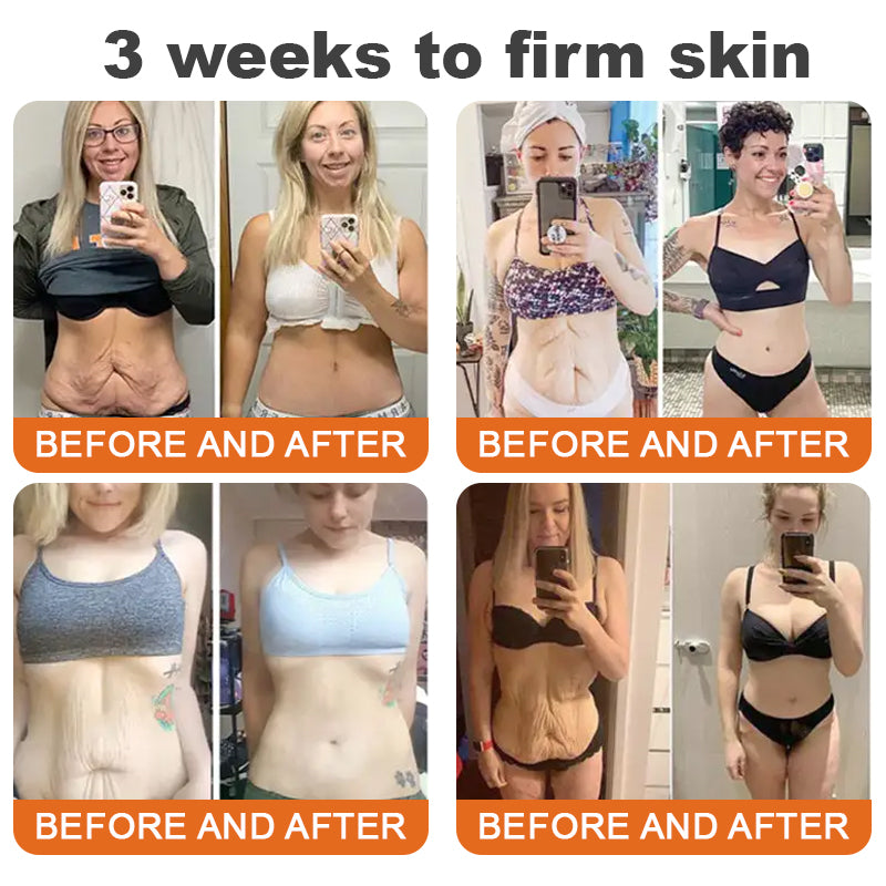 💫Rolimey® BEE VENOM Skin Restoration Cream (⏳LAST DAY 70% OFF)✨