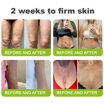 Dr. Fachmer®👩‍⚕️ Peptide Collagen INSTANT TIGHTENING + PEPTIDE FIRMING CARE, Instantly smooths puffiness and lines while supporting firmer skin with continued use