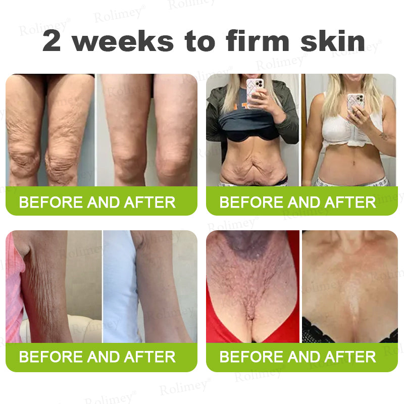 C🇺🇸Made and shipped from the USA ⌛Rolimey® Botox & Vita-A Retinol Shot Wrinkle-Lift Tightening cream - Last Day Promotion 70% OFF
