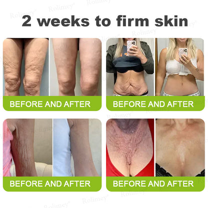 C🇺🇸Made and shipped from the USA ⌛Rolimey® Botox & Vita-A Retinol Shot Wrinkle-Lift Tightening cream - Last Day Promotion 70% OFF