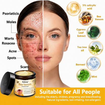 🔥Rolimey® Bee Venom Skin Treatment Cream