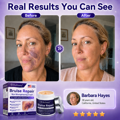 👨‍⚕️Over 100,000 units sold💕 - Rolimey® cream to repair bruises and strengthen the skin