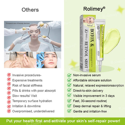 C🇺🇸Made and shipped from the USA ⌛Rolimey® Botox & Vita-A Retinol Shot Wrinkle-Lift Tightening cream - Last Day Promotion 70% OFF