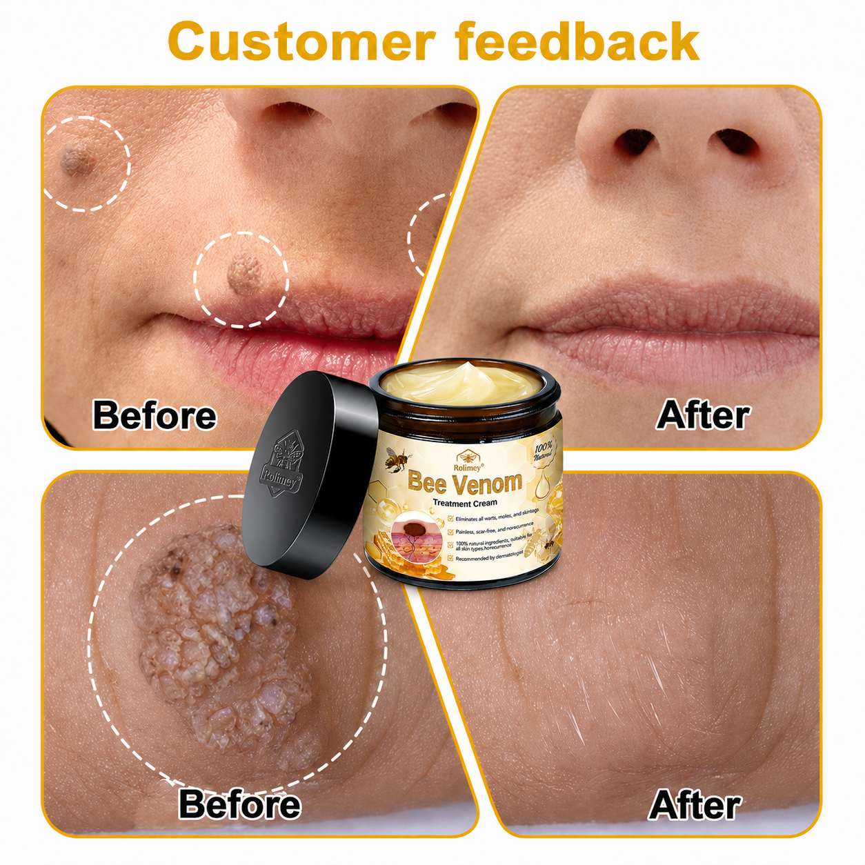 🔥Rolimey® Bee Venom Skin Treatment Cream