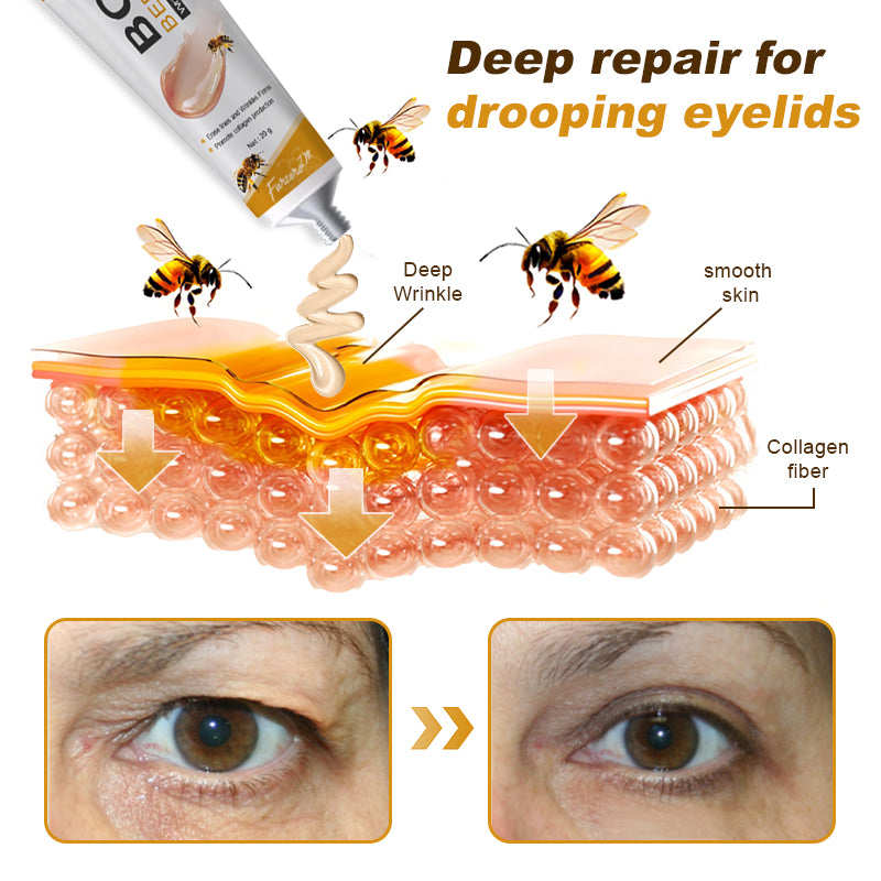 🐝✨ Made and Shipped from US ✅ Furzero™ Botox Bee Venom Wrinkle Removal Cream - LAST DAY 70% OFF