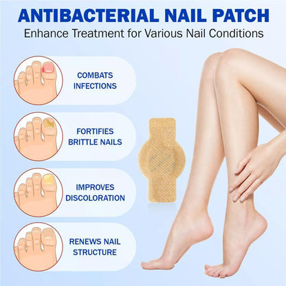 🌙 FUNGEX Overnight Nail Repair Patches - Thick & Yellow Nail Care