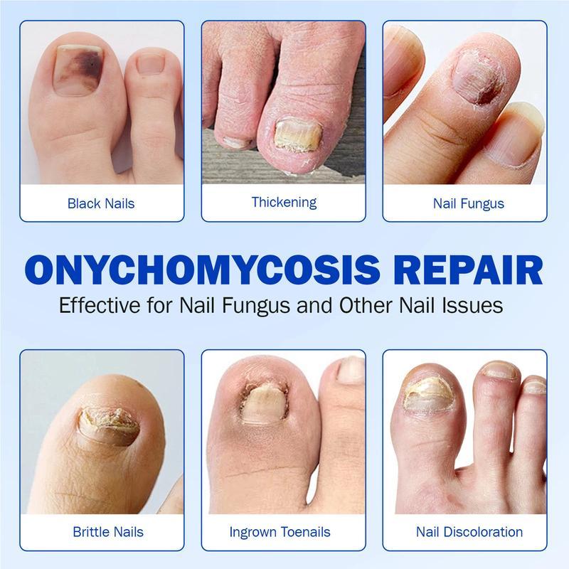 🌙 FUNGEX Overnight Nail Repair Patches - Thick & Yellow Nail Care