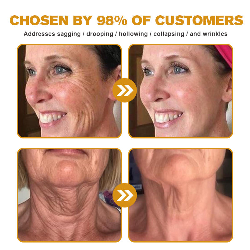 🐝✨ Made and Shipped from US ✅ Furzero™ Botox Bee Venom Wrinkle Removal Cream - LAST DAY 70% OFF