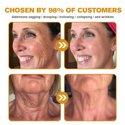 🐝✨ Made and Shipped from US ✅ Furzero™ Botox Bee Venom Wrinkle Removal Cream - LAST DAY 70% OFF