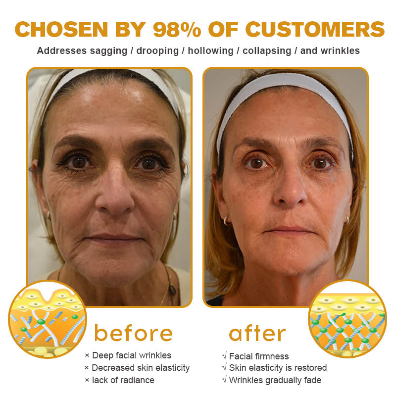 🐝✨ Made and Shipped from US ✅ Furzero™ Botox Bee Venom Wrinkle Removal Cream - LAST DAY 70% OFF