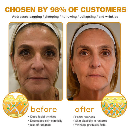🐝✨ Made and Shipped from US ✅ Furzero™ Botox Bee Venom Wrinkle Removal Cream - LAST DAY 70% OFF